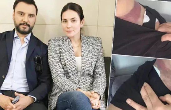 Alişan'ın liposuction davasında eşi Buse Varol tanıklık yaptı