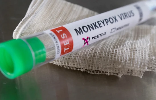 Bilim insanları uyardı! Maymun çiçeği belirtileri değişiyor!