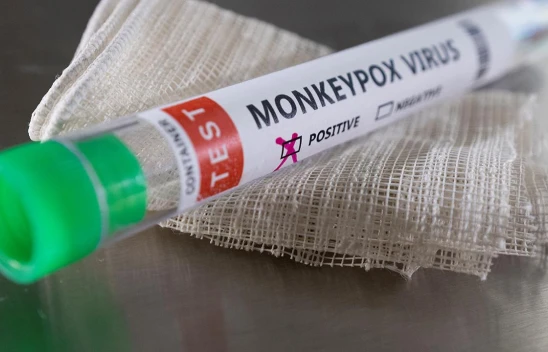 Maymun çiçeği nasıl bulaşıyor? Maymun çiçeği virüsü belirtileri neler?