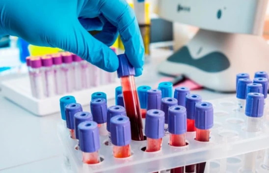 Korkutan araştırma! Hastalık riski en yüksek kan grubu ortaya çıktı!