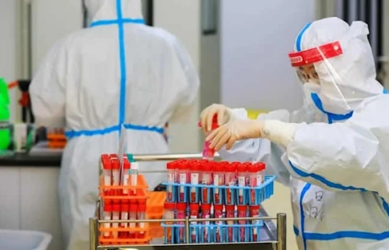 Korona virüsün nasıl çıktığıyla ilgili dehşete düşüren rapor! En ölümcül virüsleri alıp…