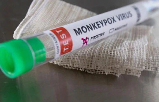 Maymun çiçeği virüsü salgını yeniden mi başladı?