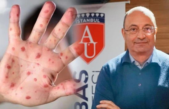 'Maymun çiçeğinin gölgesinde çiçek hastalığı ve biyolojik silah endişesi var'