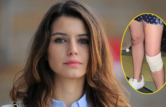 Oyuncu Beren Saat, sette kaza mı geçirdi? Gerçek ortaya çıktı!