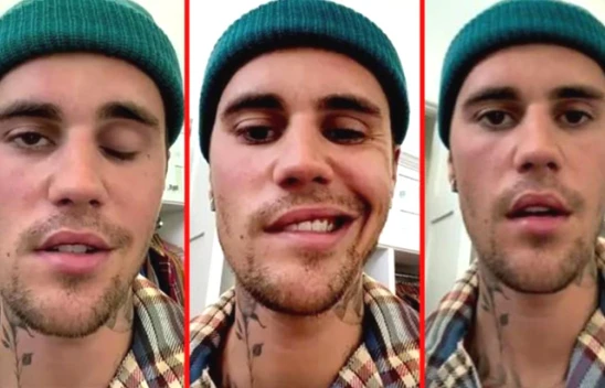 Yüz felci geçiren Justin Bieber, son durumunu paylaştı! 'Korkunç bir fırtınayla karşı karşıyayım'